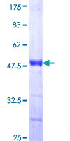 12.5% SDS-PAGE Stained with Coomassie Blue.